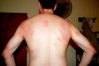 Nighttime snack for mosquitoes, Esteros del Ibera, Argentina Nighttime snack for mosquitoes, Esteros del Ibera, Argentina